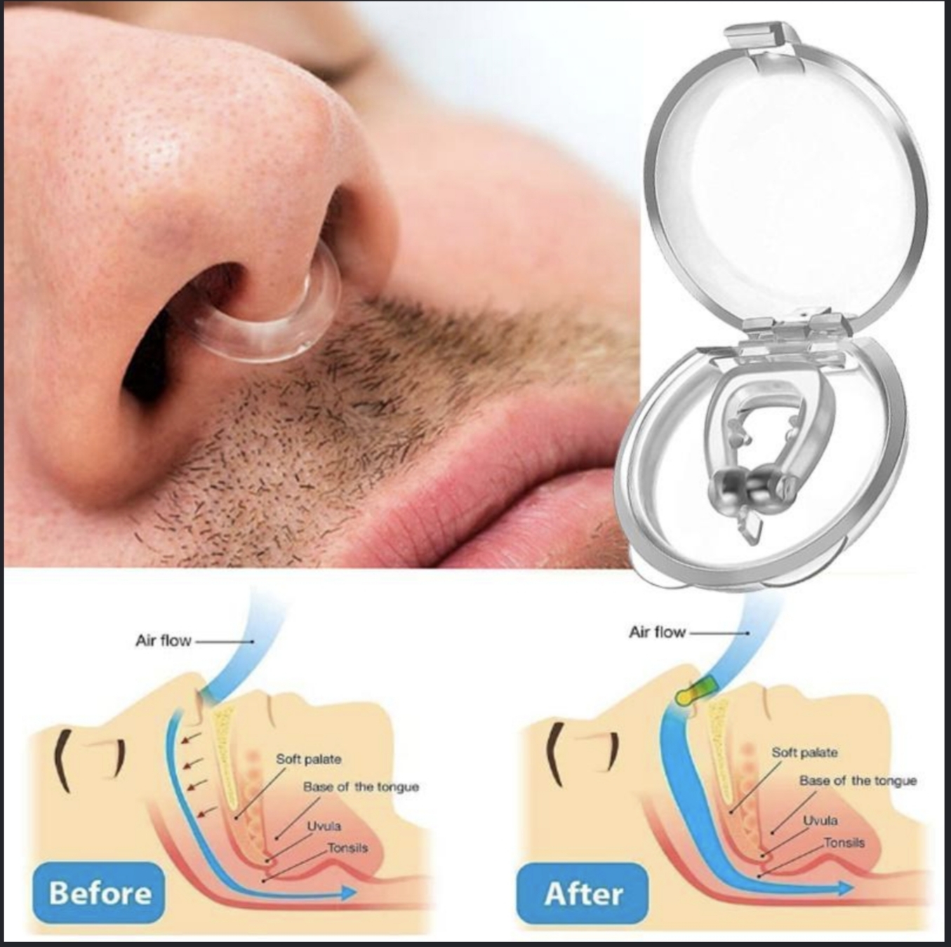 Antirronquido Nasal con Iman - Imagen 3